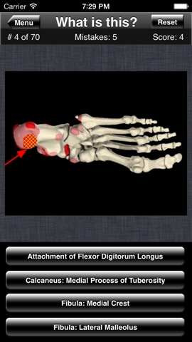Anatomy Foot Quizのおすすめ画像4
