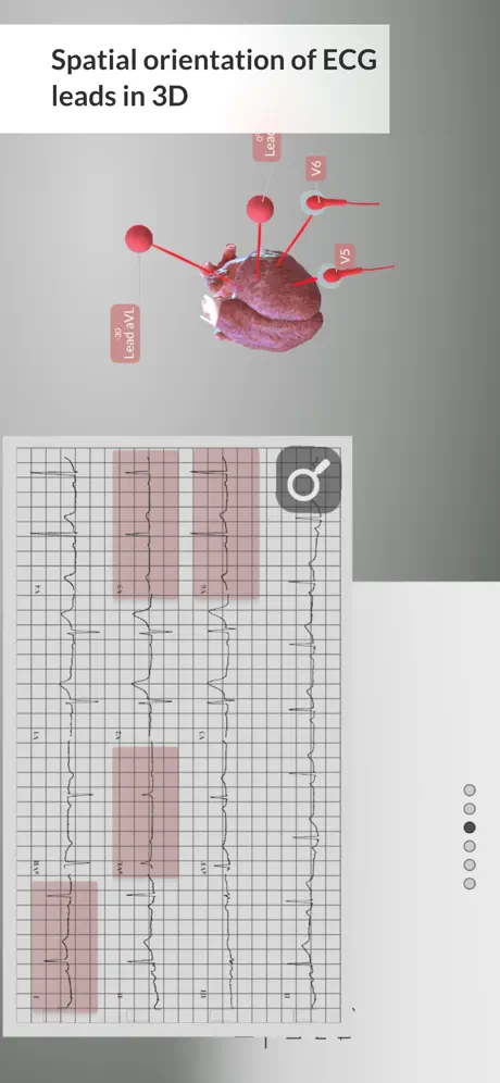 3D ECG Leads