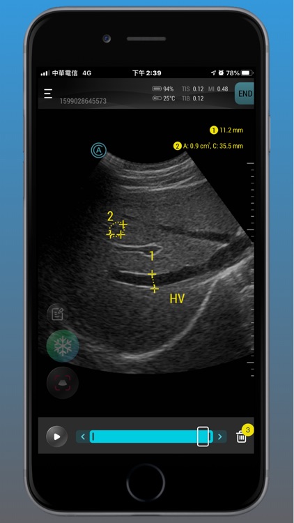 Aco Apache Ultrasound App