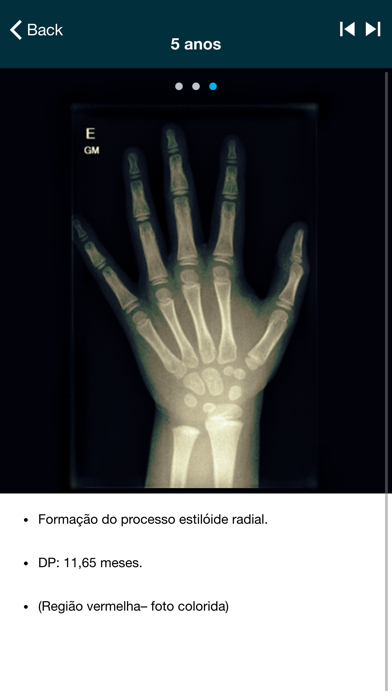 DIAX - Idade Ósseaのおすすめ画像6