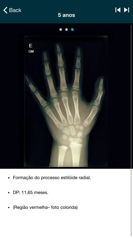 DIAX - Idade Óssea screenshot 6 of 10