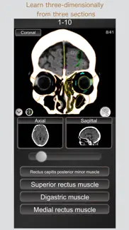 ct passquiz head/brain / mri iphone screenshot 3