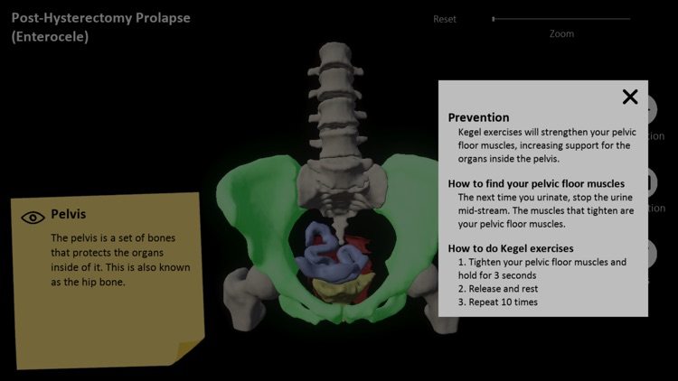 myProlapse screenshot-3