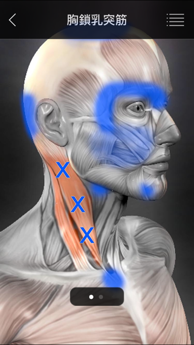 筋のトリガーポイントのおすすめ画像4