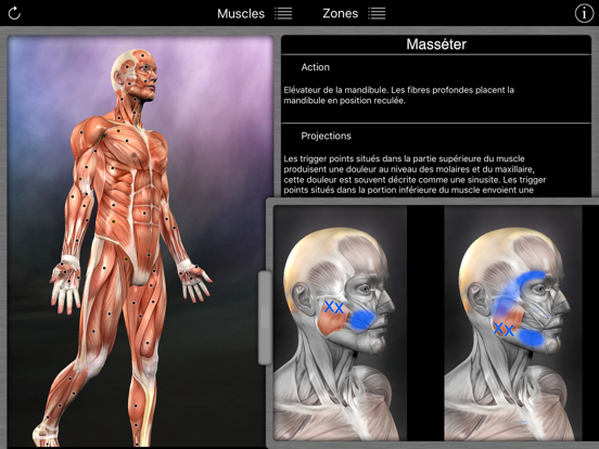Screenshot #6 pour Muscle Trigger Points