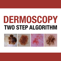 Dermoscopy Two Step Algorithm