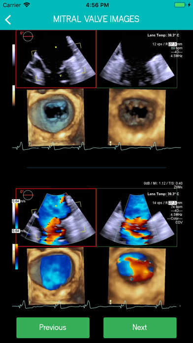 Mitral View Screenshot