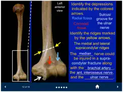 MSK Anatomy - SecondLook iPad image 2
