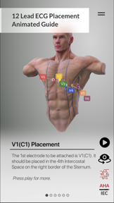 3D ECG Leads screenshot