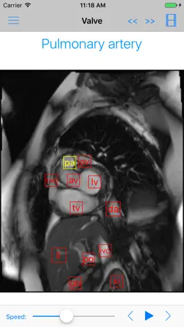 Game screenshot iAnatomy-Cardiac apk