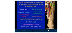 MSK Anatomy - SecondLook screenshot #4 for iPhone