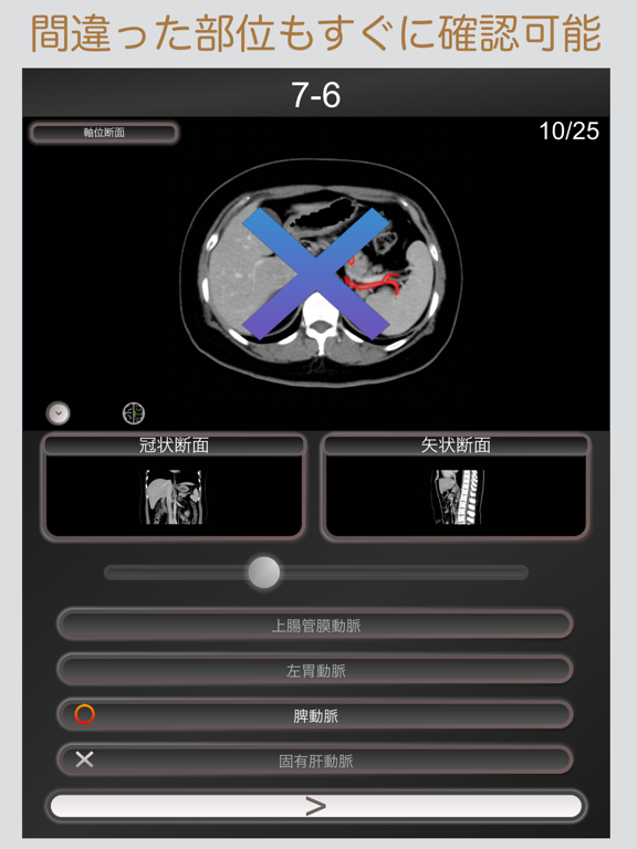 CT PassQuiz 腹部 / 断面図/解剖 /MRIのおすすめ画像2
