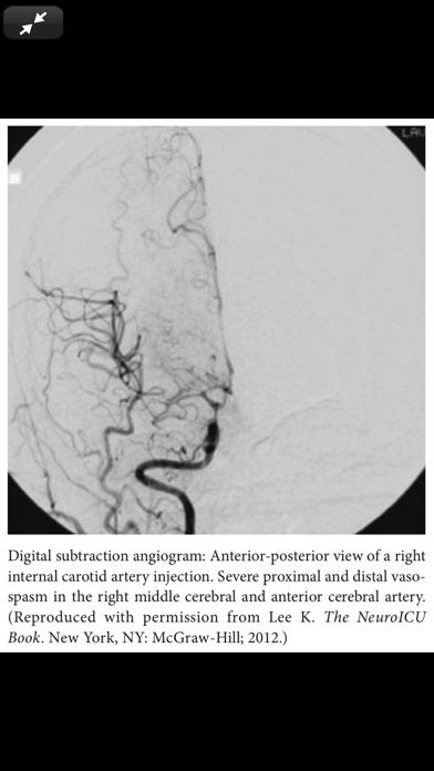The NeuroICU Board Review Screenshot