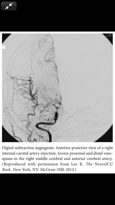 The NeuroICU Board Reviewのおすすめ画像5