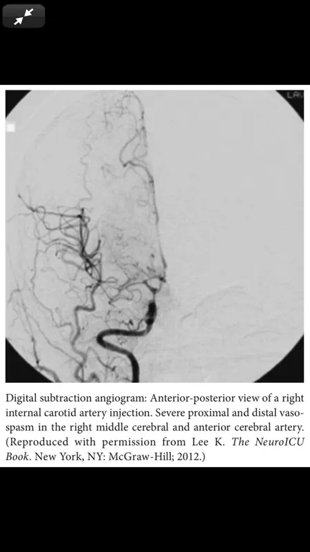 The NeuroICU Board Review screenshot 5 of 10