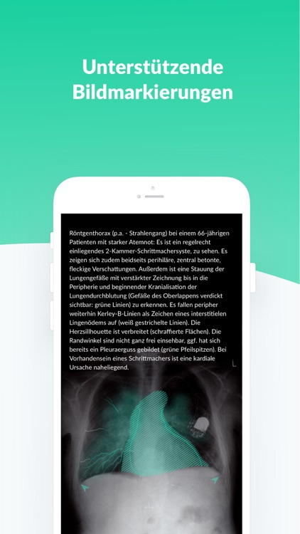 AMBOSS Kreuzen für Mediziner screenshot-7
