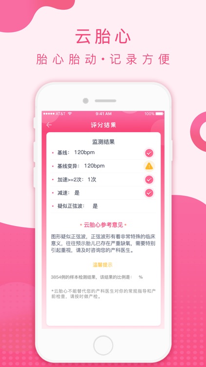 云胎心-胎心监护