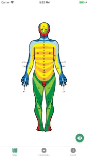 dermatomes problems & solutions and troubleshooting guide - 3