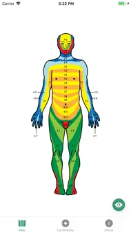 Dermatomes iphone bilder 1