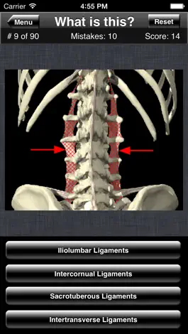 Game screenshot Anatomy Spine Quiz hack