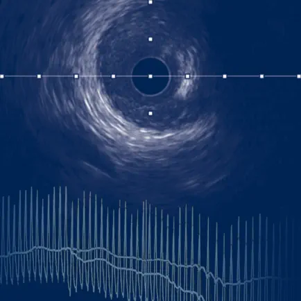 IVUS + Physiology Pro Cheats