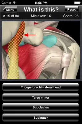 Game screenshot Anatomy Shoulder Quiz apk