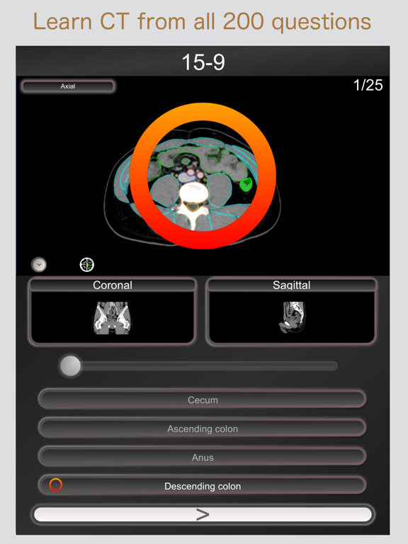 Screenshot #4 pour CT PasseQuiz Abdomen / IRM