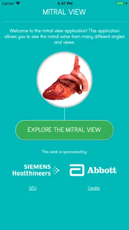 Game screenshot Mitral View mod apk