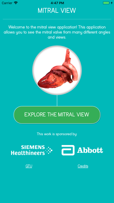 Mitral View Screenshot