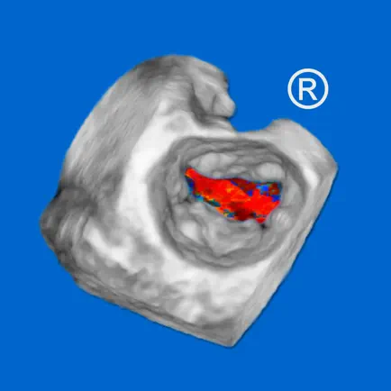 CARDIO3® 3D Echocardiography Cheats