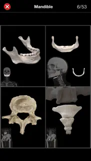 anatomy quiz pro iphone capturas de pantalla 4