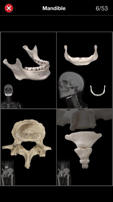 Anatomy Quiz Pro Screenshot 4