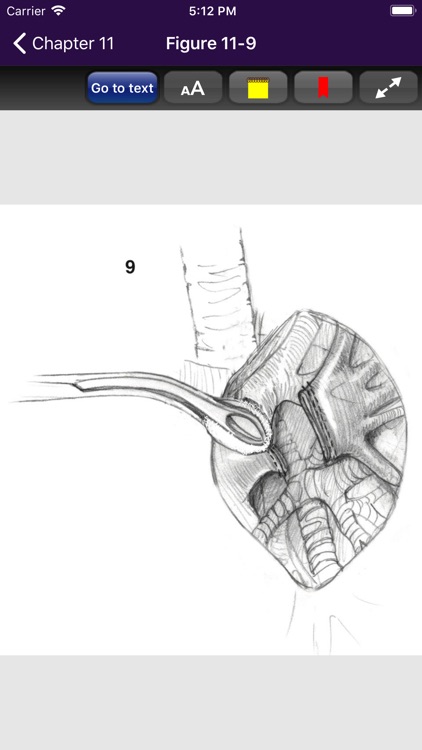 Atlas of Min. Invasive Surgery screenshot-5