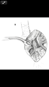 Atlas of Min. Invasive Surgery screenshot
