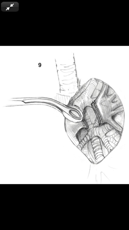 Atlas of Min. Invasive Surgery screenshot-6