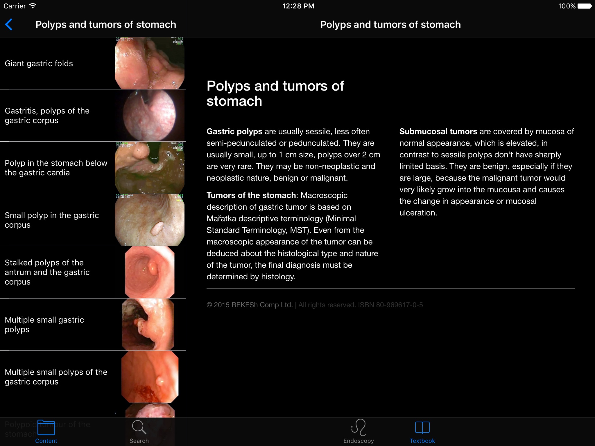 ENDO3®Atlas of GI Endoscopy HD screenshot 4