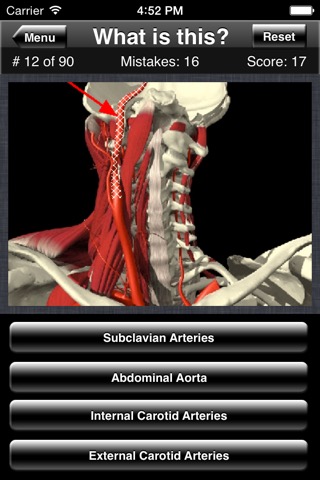 Anatomy Spine Quizのおすすめ画像4