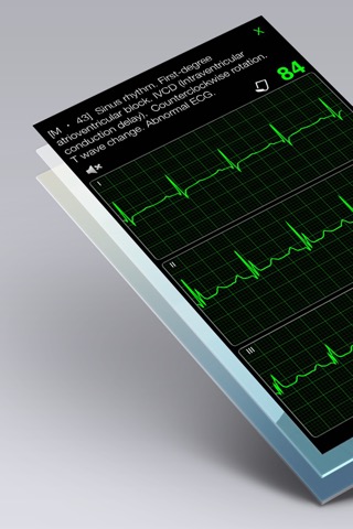 心電図ブック - ECG (EKG) Booksのおすすめ画像3