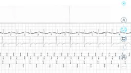 Game screenshot Cardiac Device Challenge apk