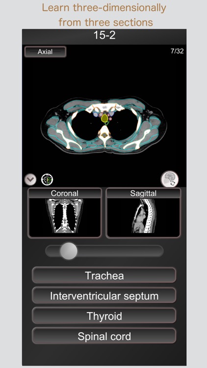 CT PassQuiz Chest / MRI