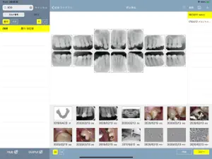 DentalXR TaKe screenshot 3