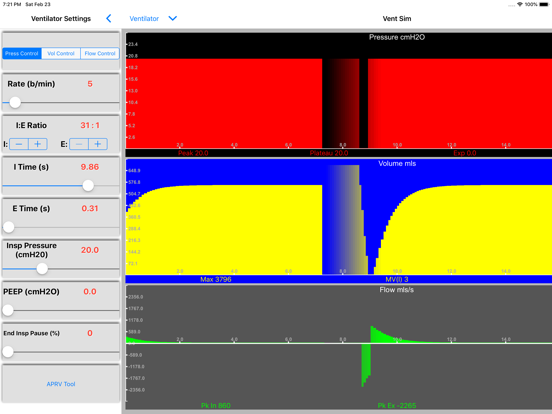 VentSim iPad app afbeelding 6