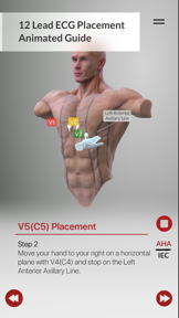 3D ECG Leads screenshot