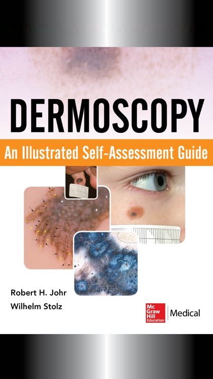 Dermoscopy Self-Assessment