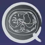 CT PassQuiz Abdomen / MRI App Problems