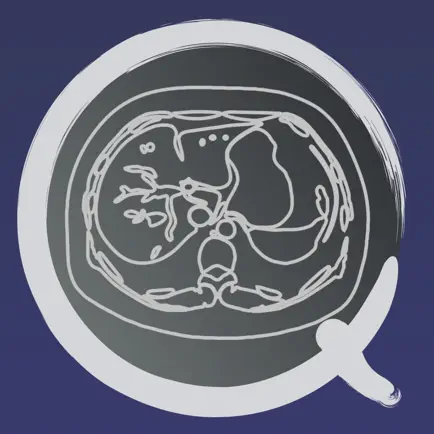 CT PassQuiz Abdomen / MRI Cheats