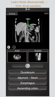 ct passquiz abdomen / mri iphone screenshot 3