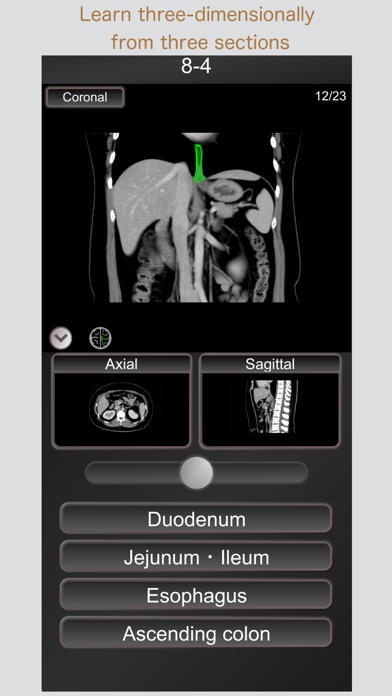 CT PassQuiz Abdomen / MRI Screenshot