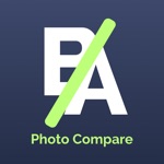Download Before and After Photo Compare app