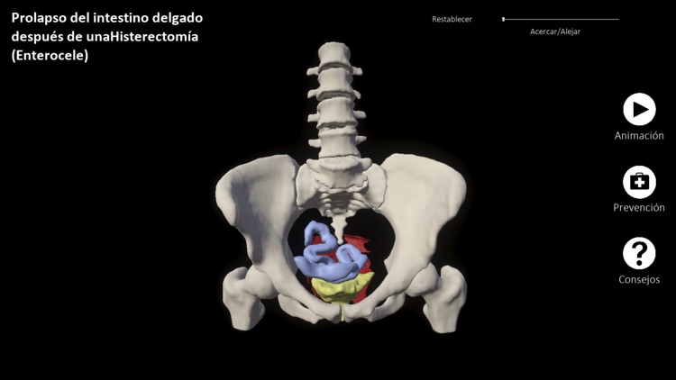 myProlapse screenshot-4